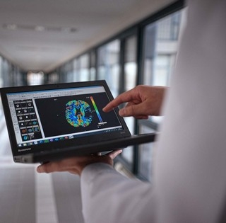 Mesterséges intelligencia segíti a stroke kezelését - Egyedülálló megoldást dolgoztak ki pécsi orvosok Mesterséges intelligencia segíti a stroke kezelését - Egyedülálló megoldást dolgoztak ki pécsi orvosok