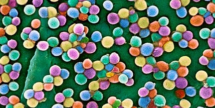 MRSA-baktériumokat MRSA-baktériumokat