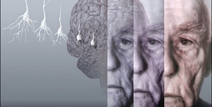 A halolajkapszulák szedése nem véd meg a demenciától A halolajkapszulák szedése nem véd meg a demenciától