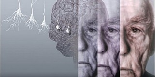A halolajkapszulák szedése nem véd meg a demenciától A halolajkapszulák szedése nem véd meg a demenciától