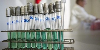 Eddig operálhatatlan betegeken segít a pécsi szívklinika világszínvonalú, új laboratóriuma