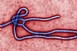Hazánkat nem veszélyezteti az Ebola-járvány Hazánkat nem veszélyezteti az Ebola-járvány