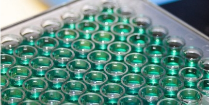 Dán cég vásárolta fel a pécsi biotechnológiai vállalkozást Dán cég vásárolta fel a pécsi biotechnológiai vállalkozást