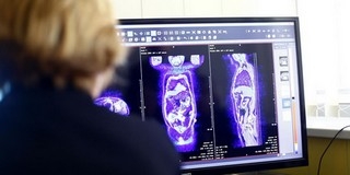 Új képalkotó készülékekkel gazdagodott a Klinikai Központ, gyorsabbak lesznek a vizsgálatok Új képalkotó készülékekkel gazdagodott a Klinikai Központ, gyorsabbak lesznek a vizsgálatok