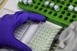 Új immunterápia segítheti a fej- és nyakrákosok kezelését Új immunterápia segítheti a fej- és nyakrákosok kezelését