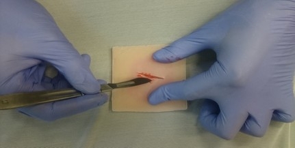 3D nyomtatással készítettek vérzést imitáló bőrt a Pécsi Tudományegyetem kutatói